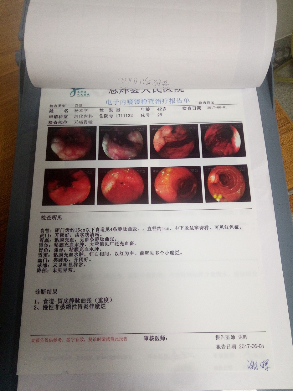 贵州省息烽县食管胃静脉曲张硬化治疗手把手教学简报